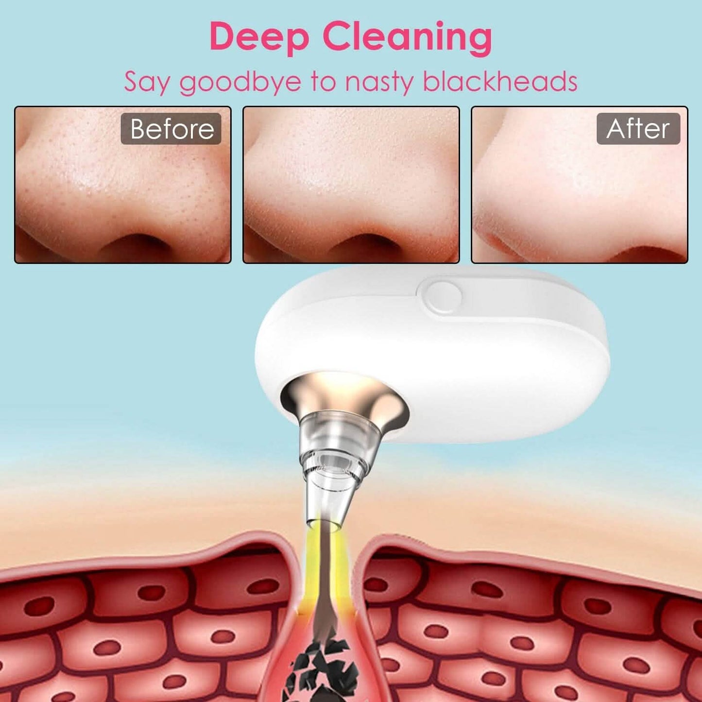 Electric Blackhead Comedone Extractor Tool Facial Pore Cleaner DailySale