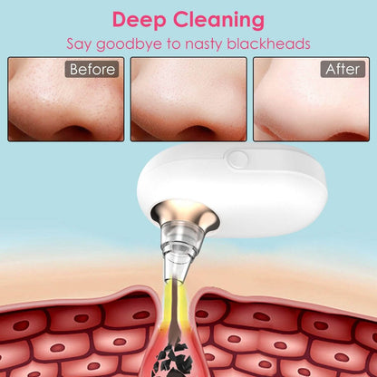 Electric Blackhead Comedone Extractor Tool Facial Pore Cleaner DailySale