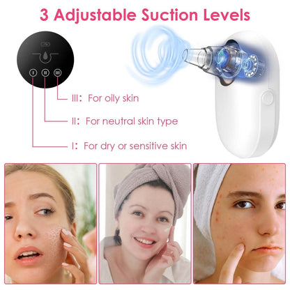 Electric Blackhead Comedone Extractor Tool Facial Pore Cleaner DailySale