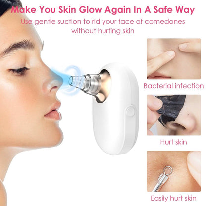 Electric Blackhead Comedone Extractor Tool Facial Pore Cleaner DailySale