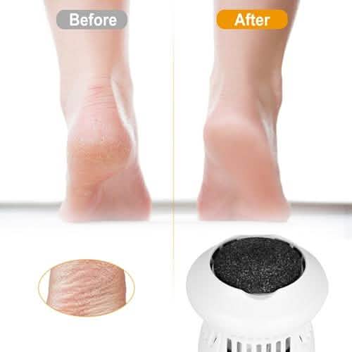 Electric Callus Grinder USB Rechargeable DailySale