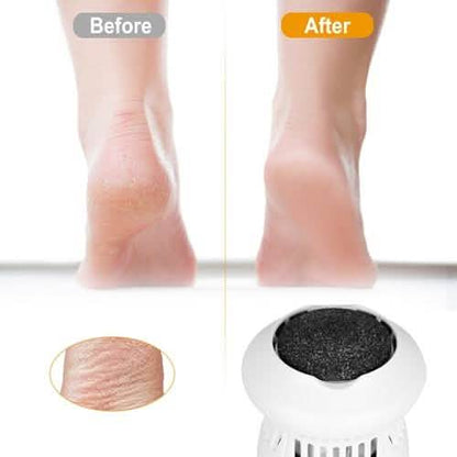 Electric Callus Grinder USB Rechargeable DailySale