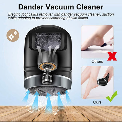 Electric Foot Callus Remover with Vacuum Cleaner DailySale