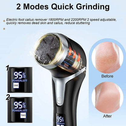 Electric Foot Callus Remover with Vacuum Cleaner DailySale