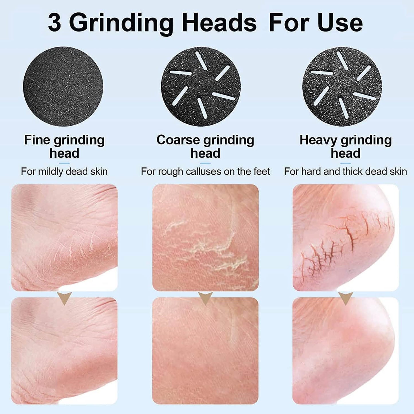 Electric Foot Callus Remover with Vacuum Cleaner DailySale