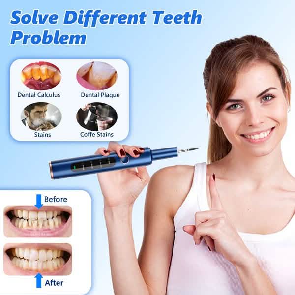 Electric Plaque Remover for Teeth, Rechargeable Teeth Cleaning Kit with 4 Modes DailySale