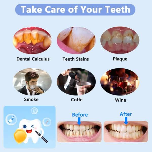 Electric Plaque Remover for Teeth, Rechargeable Teeth Cleaning Kit with 4 Modes DailySale