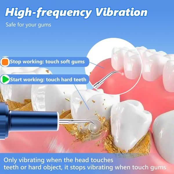 Electric Plaque Remover for Teeth, Rechargeable Teeth Cleaning Kit with 4 Modes DailySale