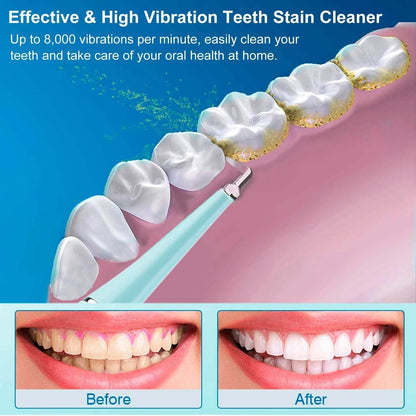 Electric Tartar Remover For Teeth DailySale