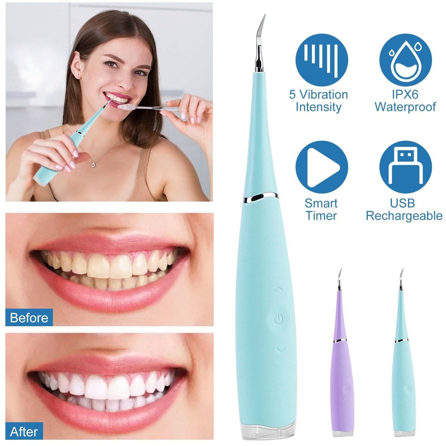 Electric Tartar Remover For Teeth DailySale