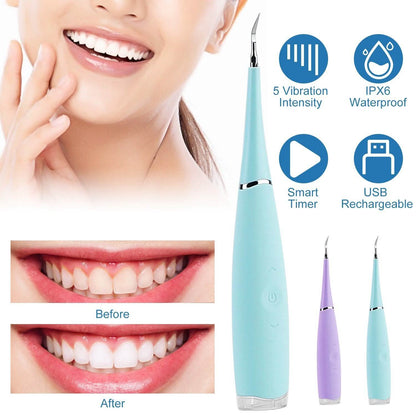 Electric Tartar Remover For Teeth DailySale
