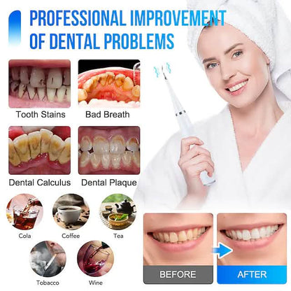 Electric Toothbrush Sonic Dental Scaler Teeth Whitening Kit DailySale