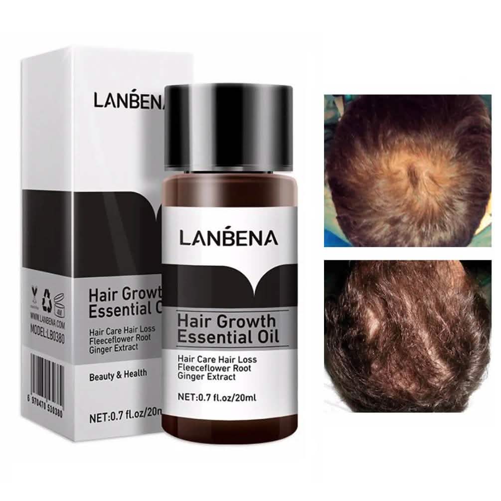Essential Oil For Hair Growth And Hair Loss Treatment For Men And Women DailySale