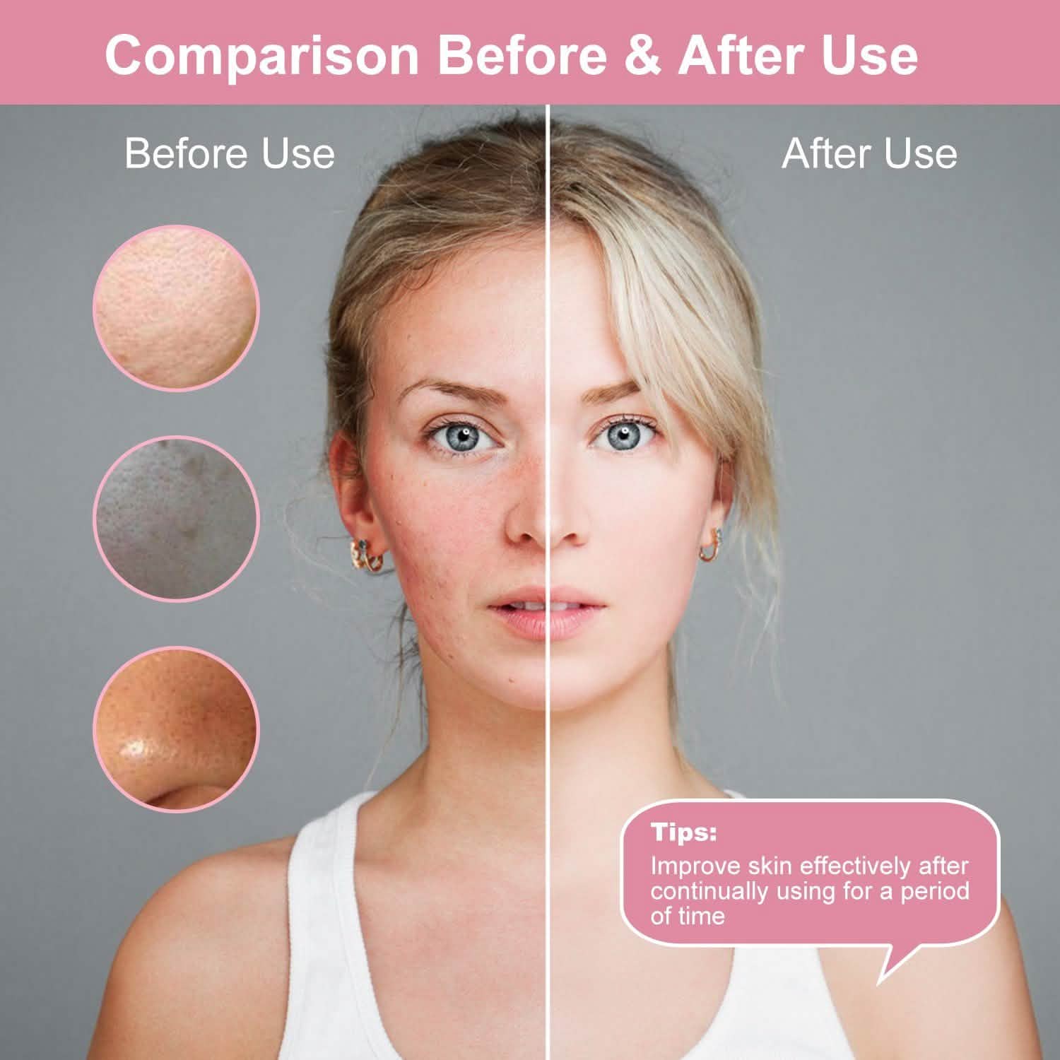 Facial Cleansing Brush IPX6 Waterproof 2 Speed Face Brush DailySale