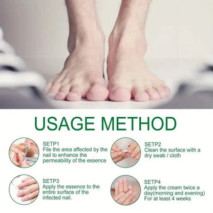 Ginger Nail Care Liquid Onychomycosis Fungus Repair Hand and Foot Nail Care DailySale