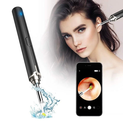 Intelligent Visual Ear Otoscope Inspection Tool DailySale