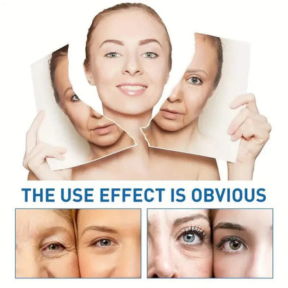 Intensive Anti Aging Botox Facial Serum - Collagen Serum For Skin With Vitamin C, Hyaluronic Acid and Niacinamide DailySale