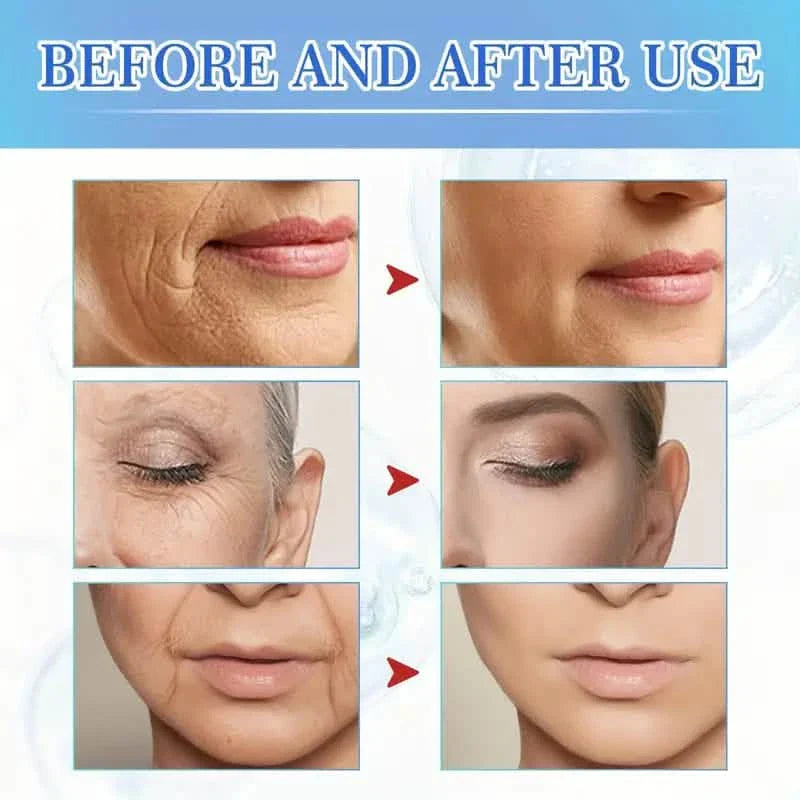 Intensive Anti Aging Botox Facial Serum - Collagen Serum For Skin With Vitamin C, Hyaluronic Acid and Niacinamide DailySale