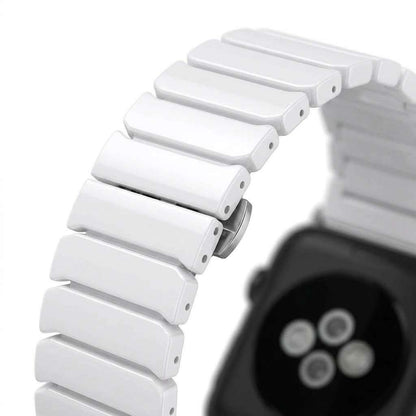 Luxe Ceramic Strap Anhem