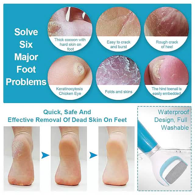 Mini Portable Electric Foot Grinding Machine DailySale