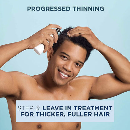 Nioxin Full-Size System Kits for Progressed to Advanced Thinning Hair DailySale
