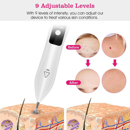 Portable Skin Tag Repair Kit with 6 Replaceable Needles DailySale