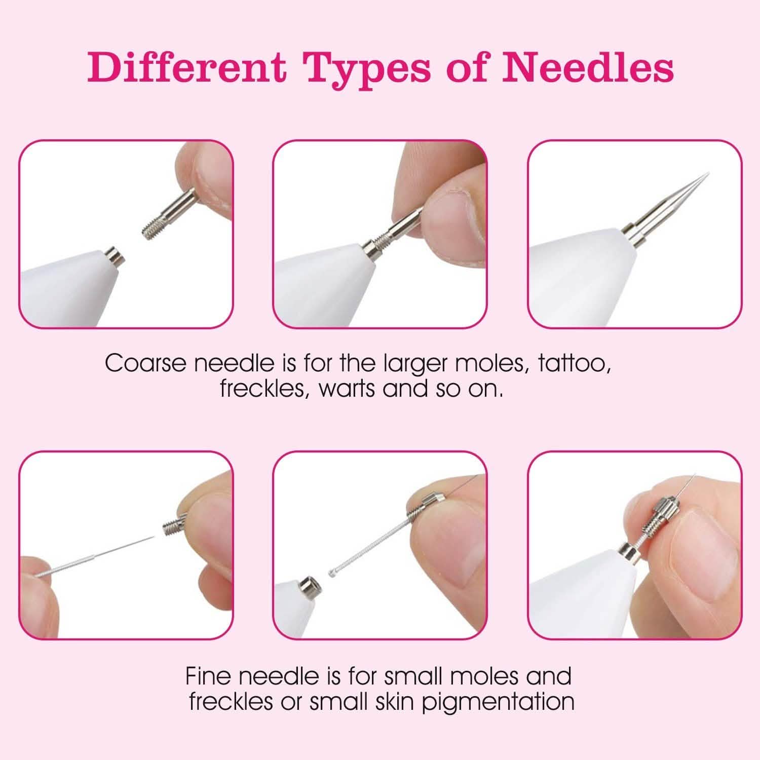 Portable Skin Tag Repair Kit with 6 Replaceable Needles DailySale