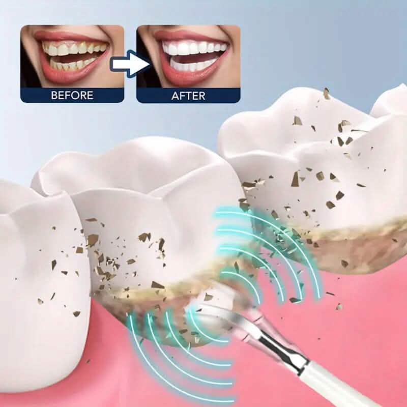 ProClean Electric Teeth Whitening Tool Set DailySale