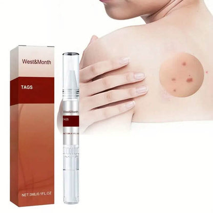 Skin Tag Removal Pen DailySale