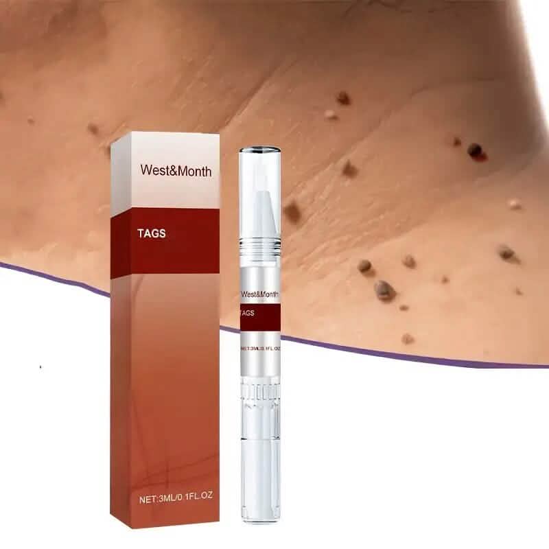 Skin Tag Removal Pen DailySale