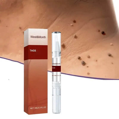 Skin Tag Removal Pen DailySale