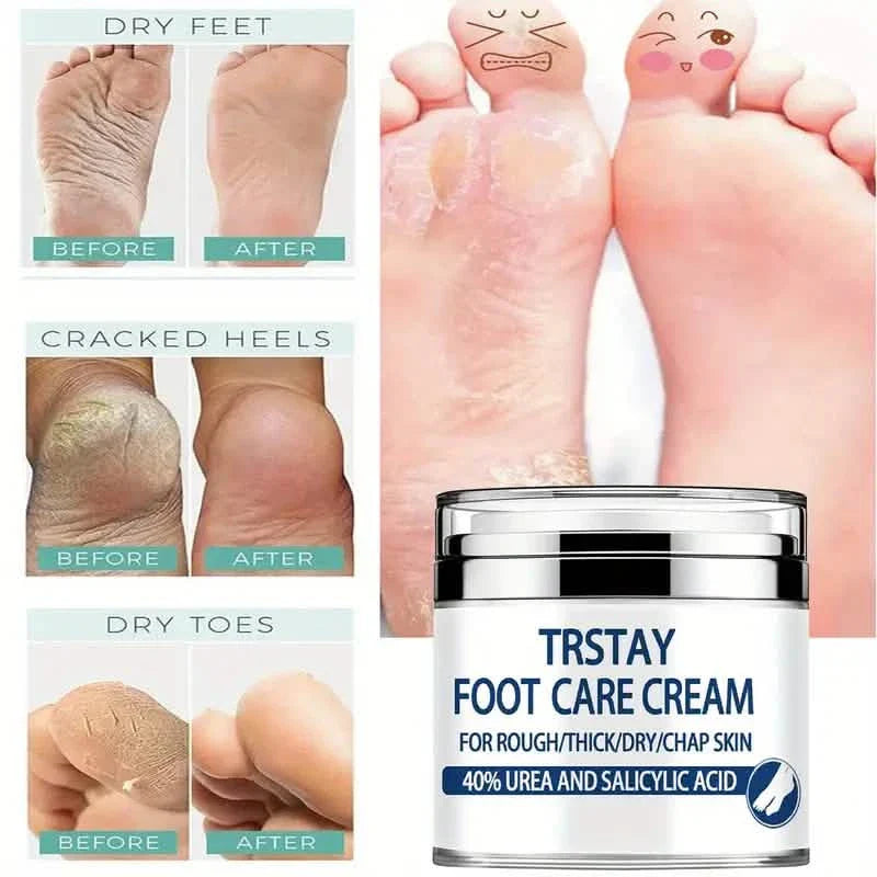 Trstay Foot Care Cream50g/ Foot Care Cream 40 Urea And Salicylic Acid DailySale