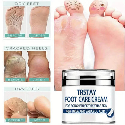 Trstay Foot Care Cream50g/ Foot Care Cream 40 Urea And Salicylic Acid DailySale