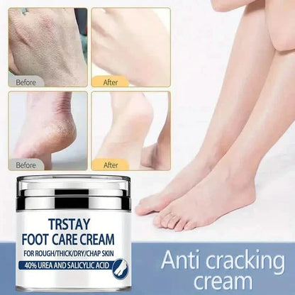 Trstay Foot Care Cream50g/ Foot Care Cream 40 Urea And Salicylic Acid DailySale