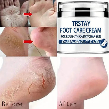 Trstay Foot Care Cream50g/ Foot Care Cream 40 Urea And Salicylic Acid DailySale