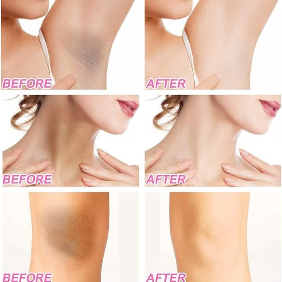Underarm Skin Whitening Cream DailySale