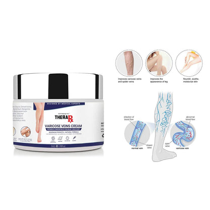 Varicose Veins Cream DailySale